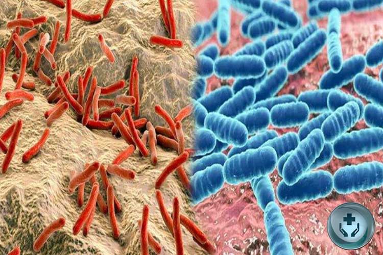 Penyakit Menular Umum yang Disebabkan oleh Bakteri