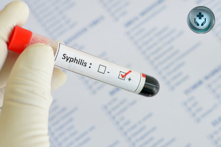 Penyakit Sifilis: Gejala, Penyebab, Diagnosis, dan Pengobatan
